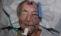 Two Held Over Horrific Attack On Pensioner