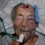 Family To Appeal After Gran Attacked In Bed